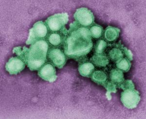 H1N1 virions (from the US Center for Disease Control image database, No. 11215)